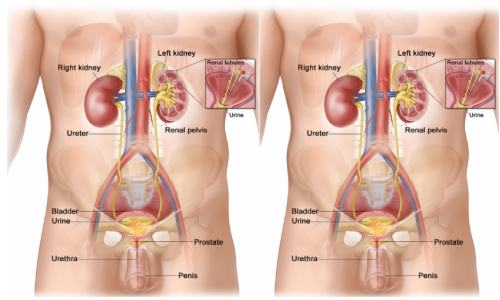 GU Cancers
